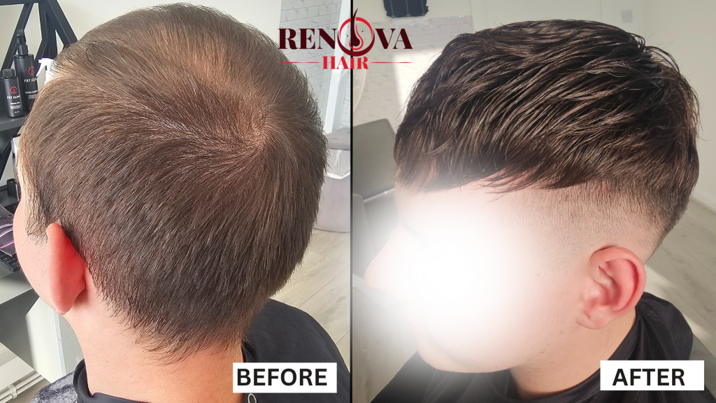 Hair System Before and After