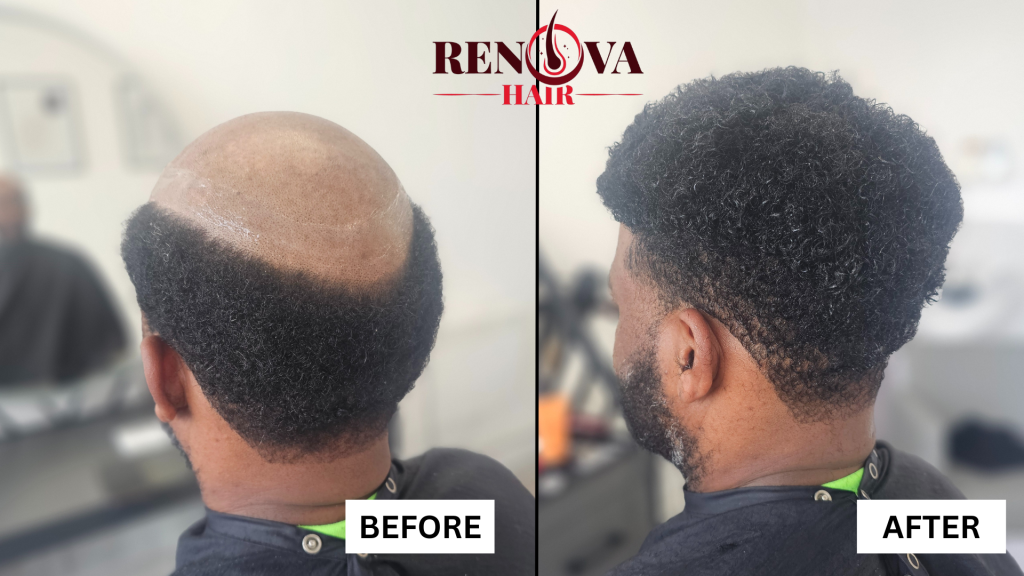 Jerome Before and After Hair System