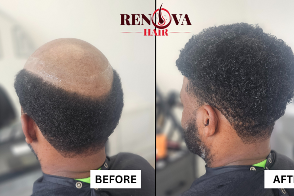 Jerome Before and After Hair System