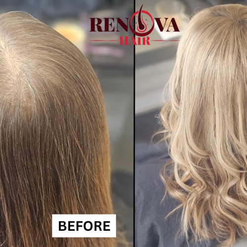 Before & After Meshless Integration